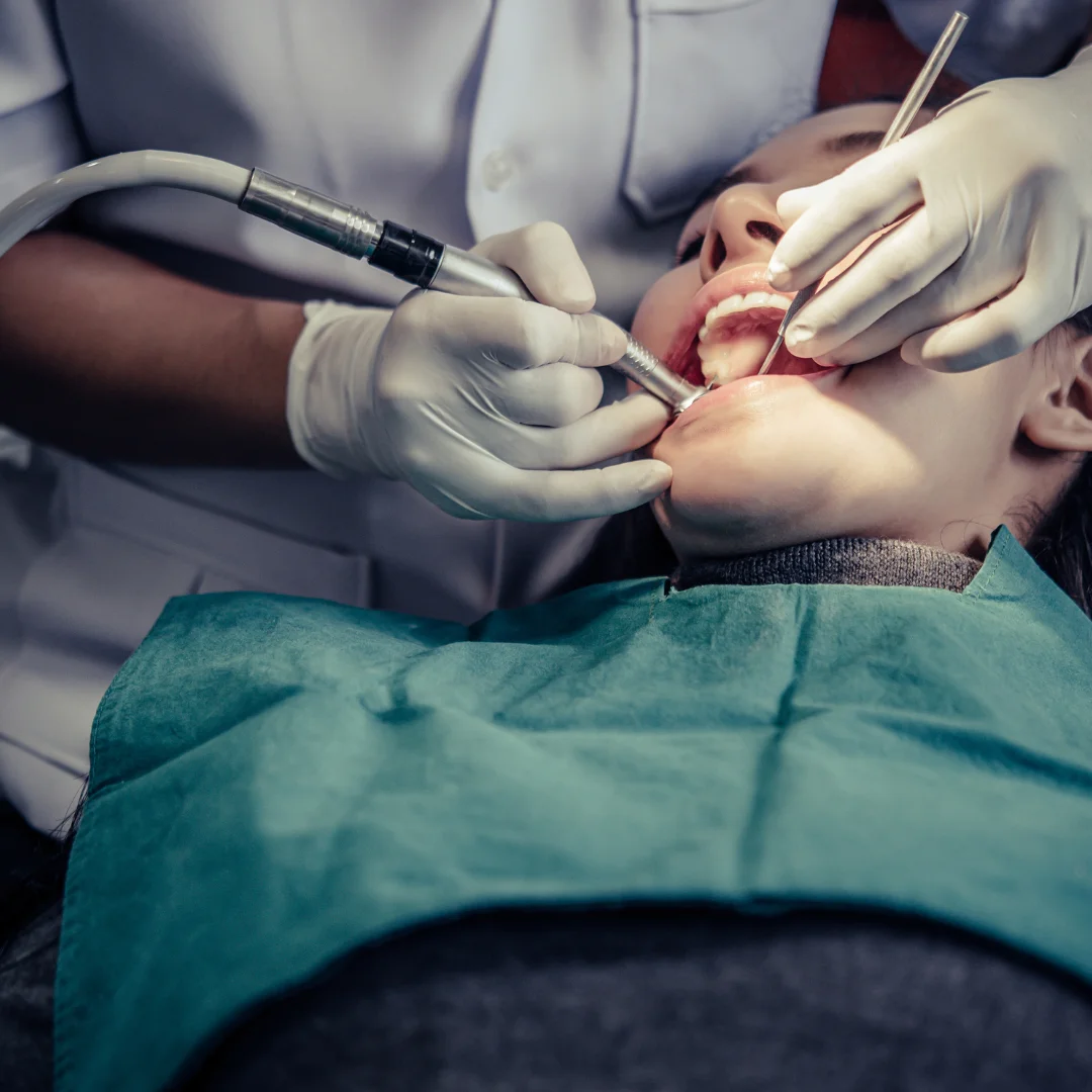 Opciones para recuperar tu sonrisa
