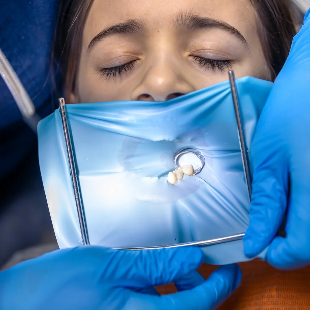 cuánto dura un implante dental