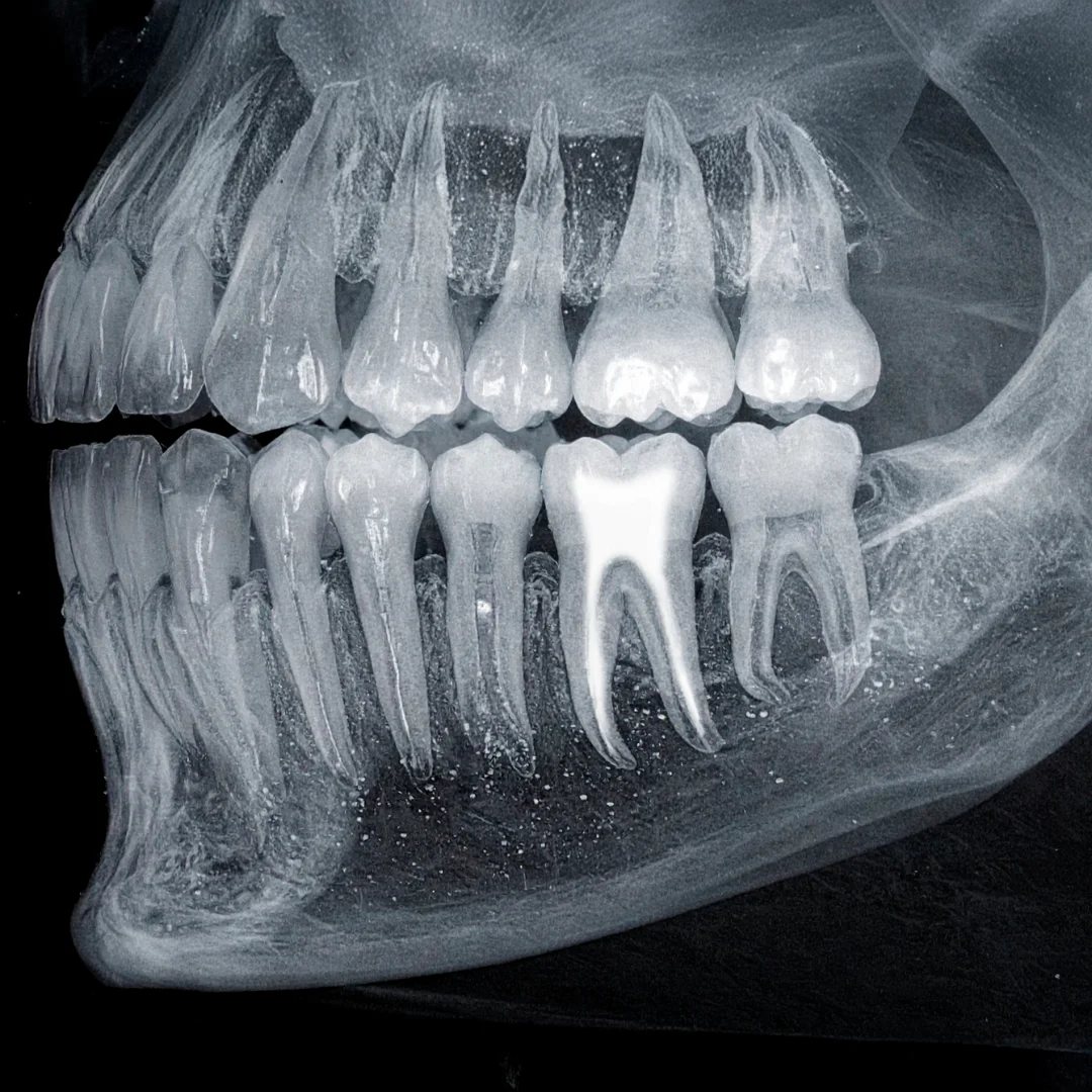 Endodoncia