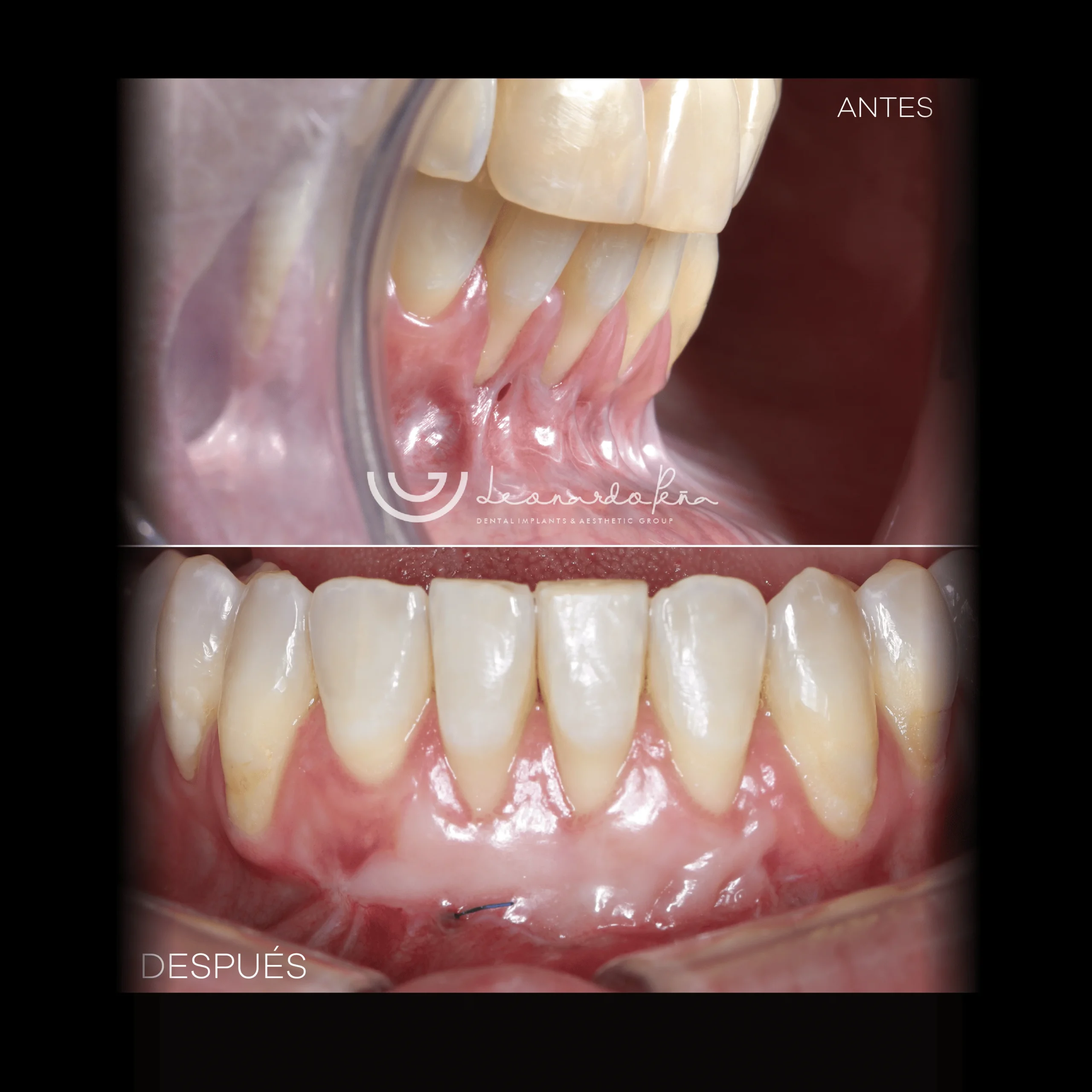 periodoncia