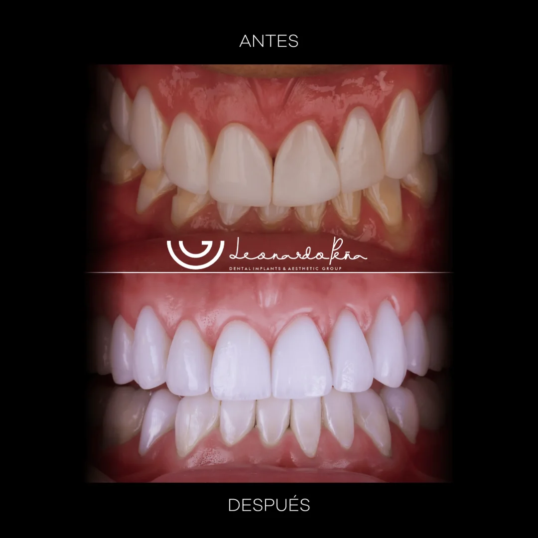 Estetica Dental