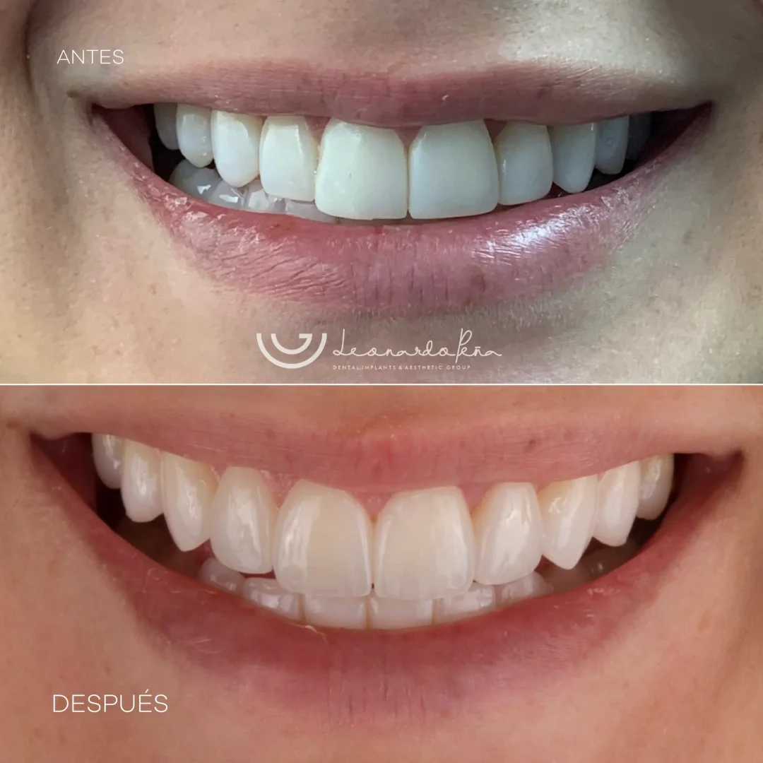 Estetica dental 2