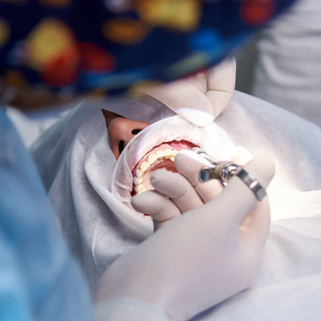 cirugia-en-la-clinica-dental-anestesia-en-cirugia-dental